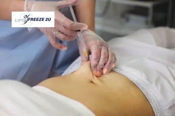 Fat Dissolving Injections Salisbury & Weight loss medication