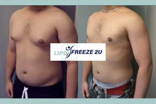 How Long Does It Take to See Results Salisbury?