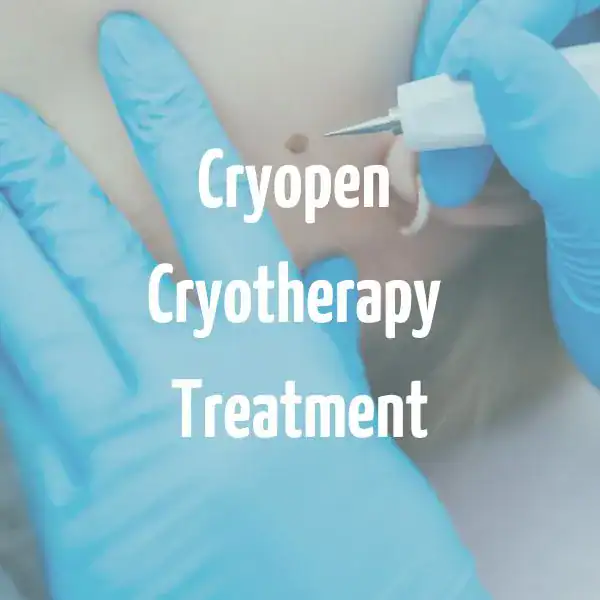 Cryopen Cryotherapy Treatment Salisbury
