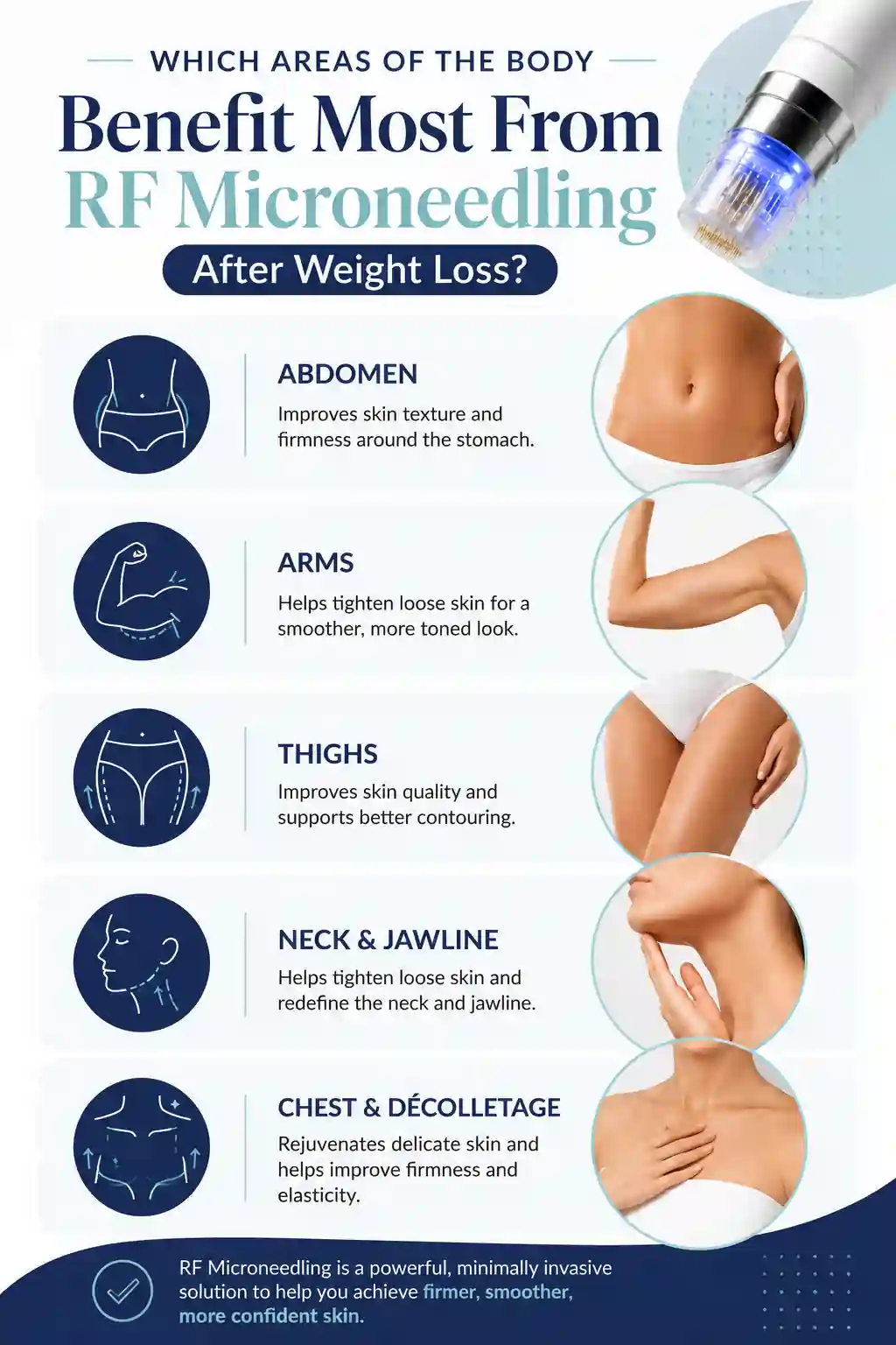 Which Areas of the Body Benefit Most From RF Microneedling After Weight Loss Salisbury