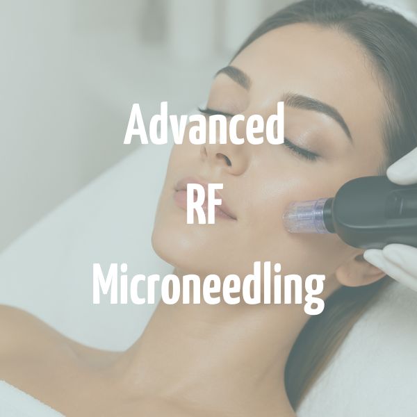 Advanced RF Microneedling Salisbury